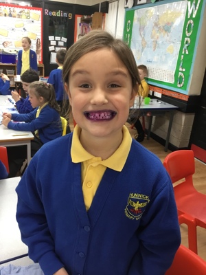 Sycamores teeth! Sycamores teeth!