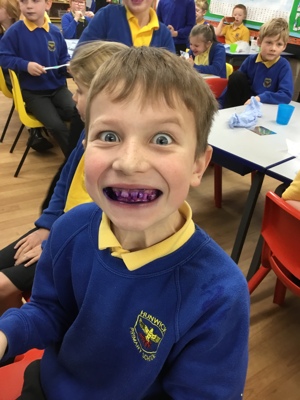 Sycamores teeth! Sycamores teeth!