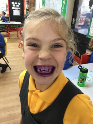 Sycamores teeth! Sycamores teeth!